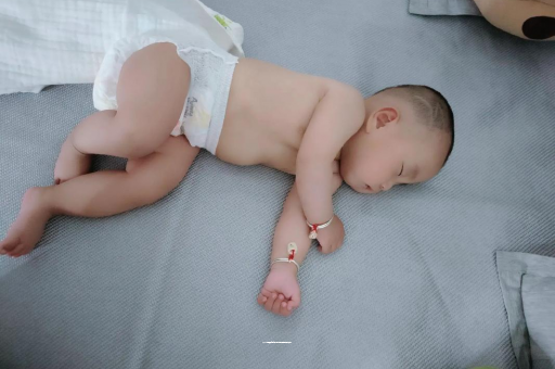 崇左六个月宝宝眼睛散光